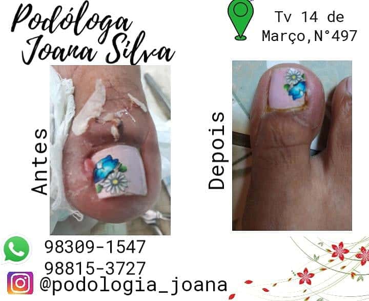 Podóloga Joana Silva